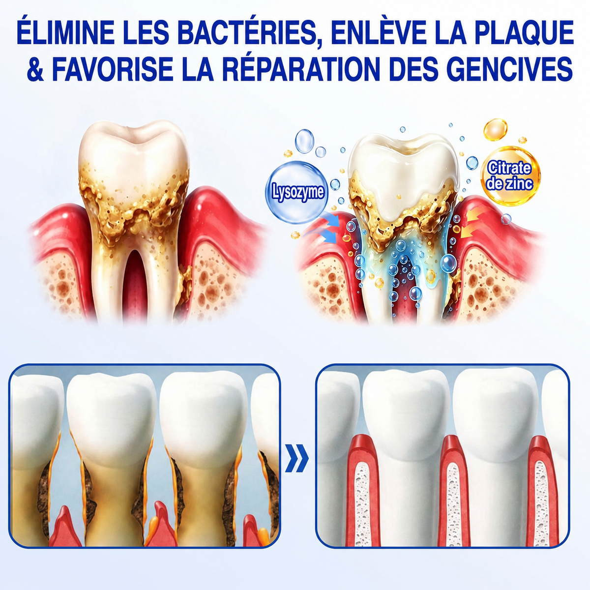 Gel Healrize® GumRevive pour la régénération des tissus parodontaux (pour les saignements et la rétraction des gencives ainsi que le déchaussement des dents)🪥🦷1