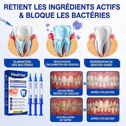 Gel Healrize® GumRevive pour la régénération des tissus parodontaux (pour les saignements et la rétraction des gencives ainsi que le déchaussement des dents)🪥🦷1